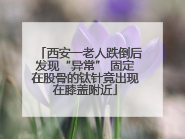 西安一老人跌倒后发现“异常” 固定在股骨的钛针竟出现在膝盖附近